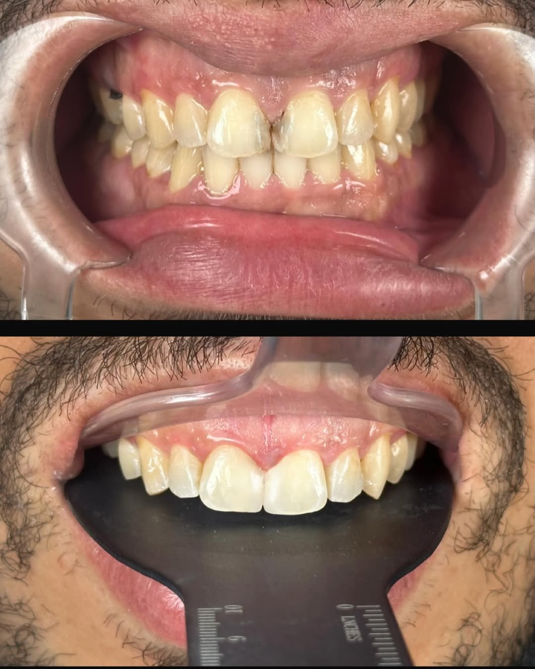 Publication Instagram de dentisterie esthétique